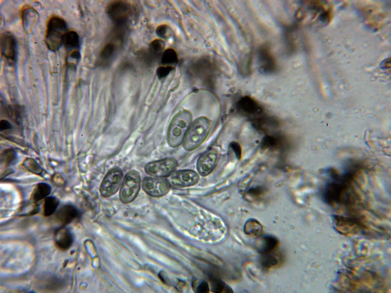 Amandinea punctata 10 - Himenio 1